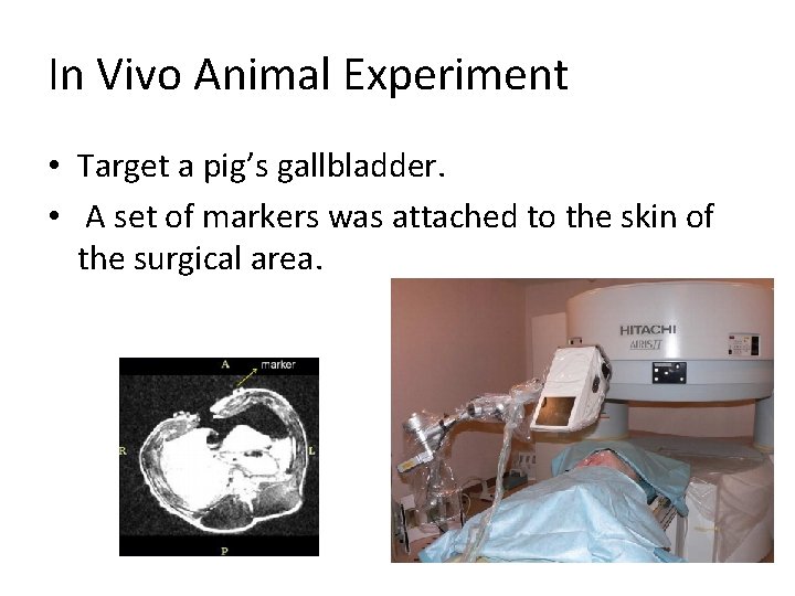 In Vivo Animal Experiment • Target a pig’s gallbladder. • A set of markers