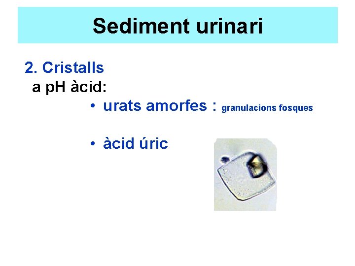 Sediment urinari 2. Cristalls a p. H àcid: • urats amorfes : granulacions fosques