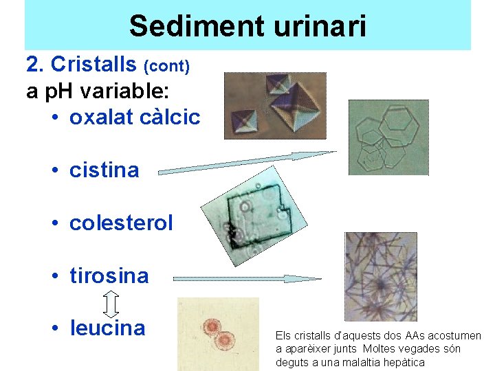 Sediment urinari 2. Cristalls (cont) a p. H variable: • oxalat càlcic • cistina