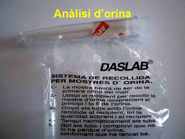 Anàlisi d’orina 