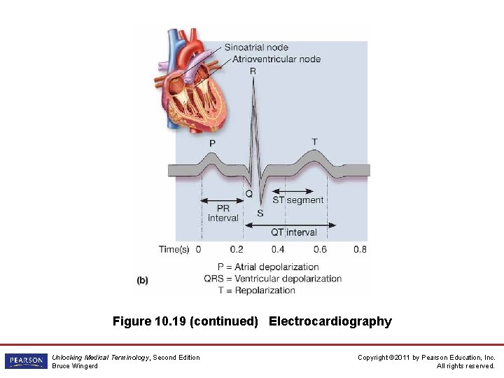 Figure 10. 19 (continued) Electrocardiography Unlocking Medical Terminology, Second Edition Bruce Wingerd Copyright ©