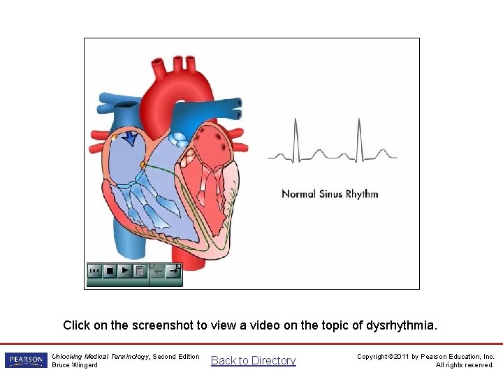 Dysrhythmia Video Click on the screenshot to view a video on the topic of