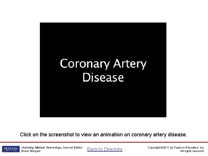 Coronary Artery Disease Animation Click on the screenshot to view an animation on coronary