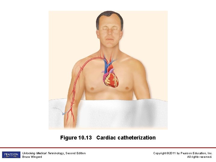 Figure 10. 13 Cardiac catheterization Unlocking Medical Terminology, Second Edition Bruce Wingerd Copyright ©