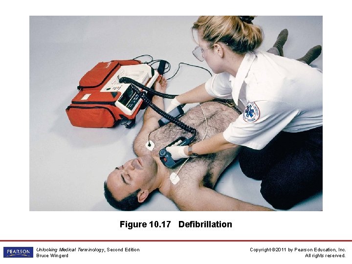 Figure 10. 17 Defibrillation Unlocking Medical Terminology, Second Edition Bruce Wingerd Copyright © 2011