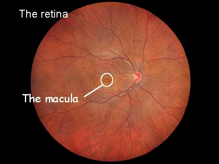 The retina The macula 