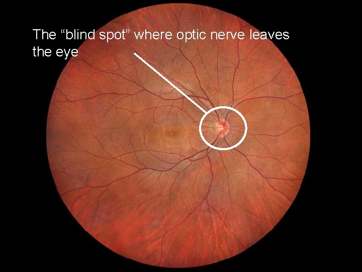 The “blind spot” where optic nerve leaves the eye 