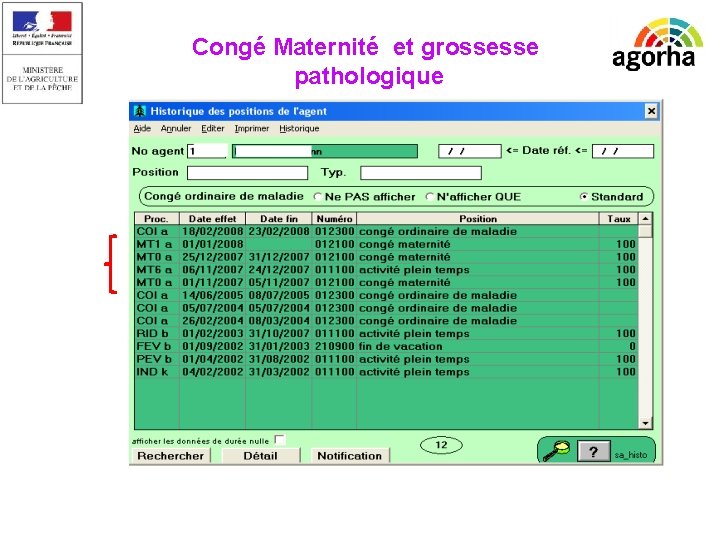 EPICEA Congé Maternité et grossesse pathologique 