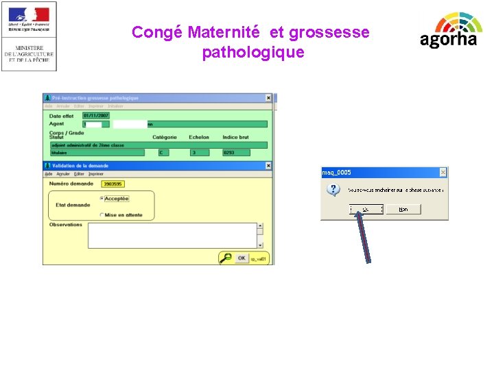 EPICEA Congé Maternité et grossesse pathologique 