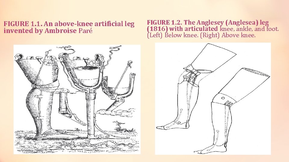 FIGURE 1. 1. An above-knee artificial leg invented by Ambroise Paré FIGURE 1. 2.