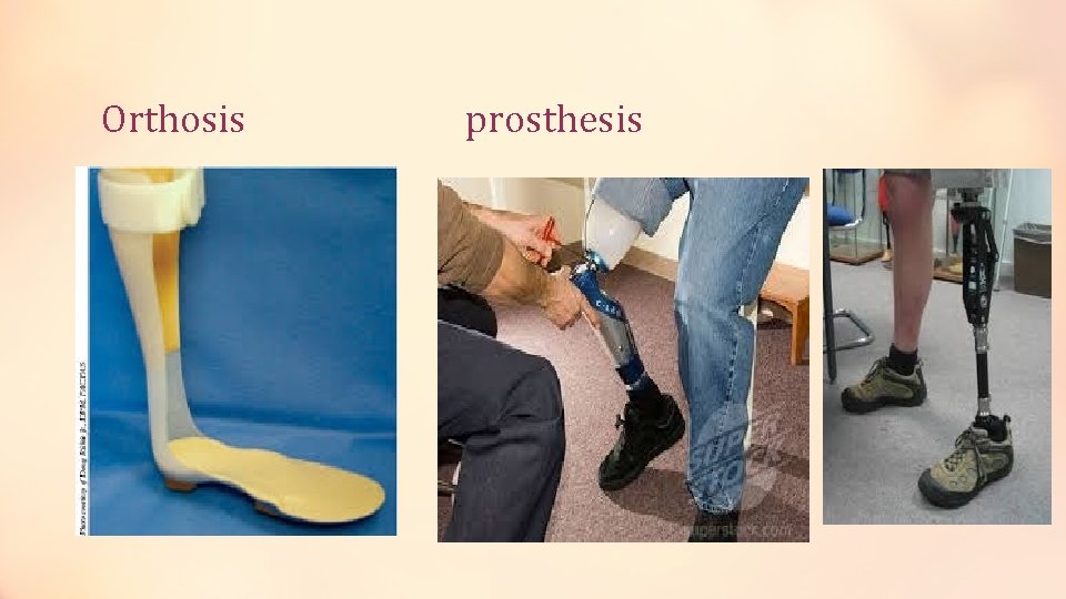 Orthosis prosthesis 