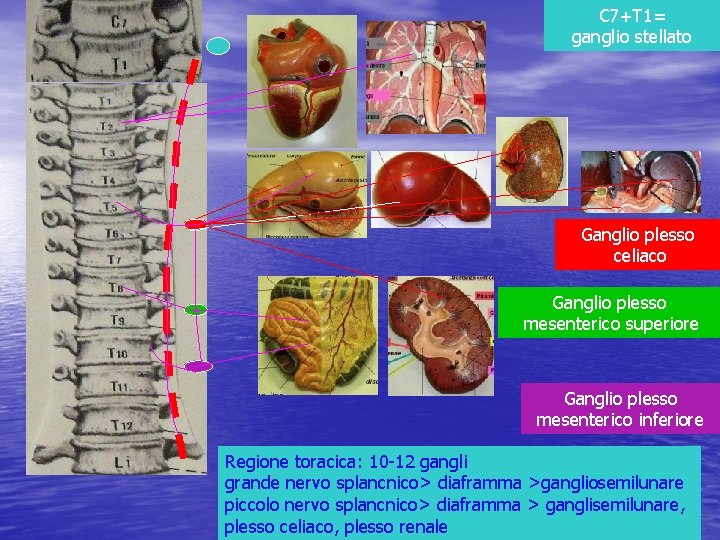 C 7+T 1= ganglio stellato Ganglio plesso celiaco Ganglio plesso mesenterico superiore Ganglio plesso