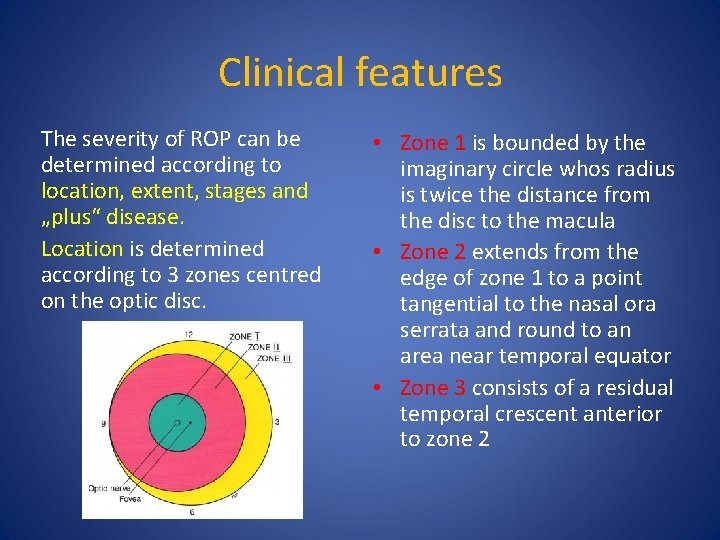Clinical features The severity of ROP can be determined according to location, extent, stages