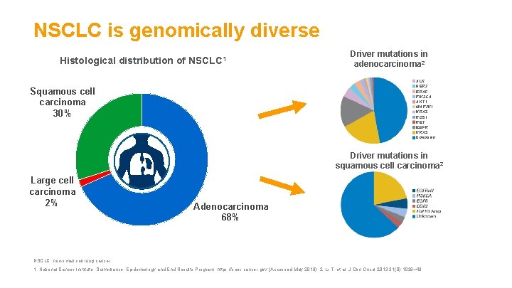 NSCLC is genomically diverse Histological distribution of NSCLC 1 Driver mutations in adenocarcinoma 2
