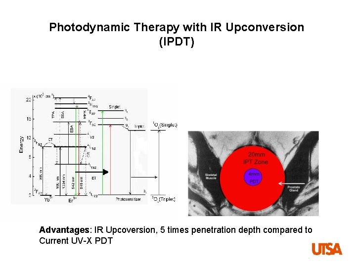 Photodynamic Therapy with IR Upconversion (IPDT) Advantages: IR Upcoversion, 5 times penetration depth compared
