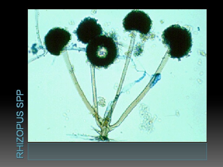 RHIZOPUS SPP 