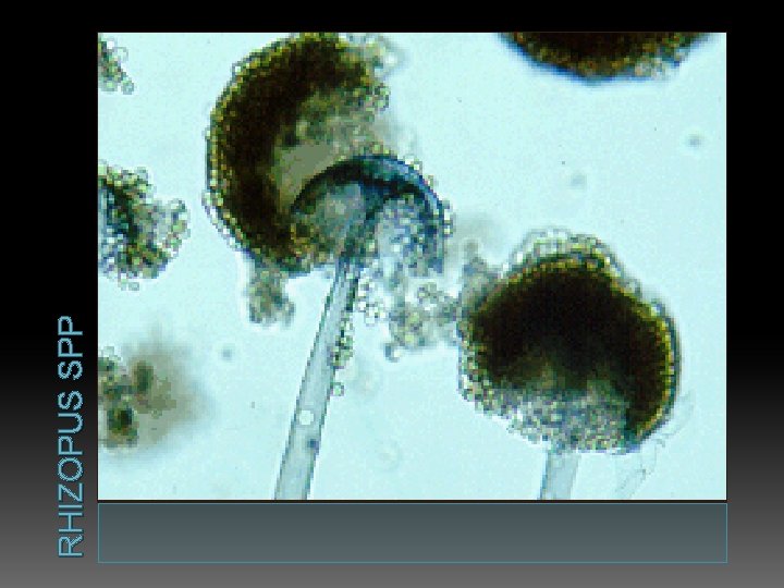 RHIZOPUS SPP 