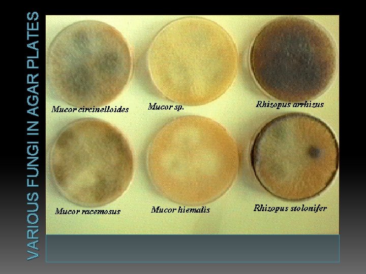 VARIOUS FUNGI IN AGAR PLATES 