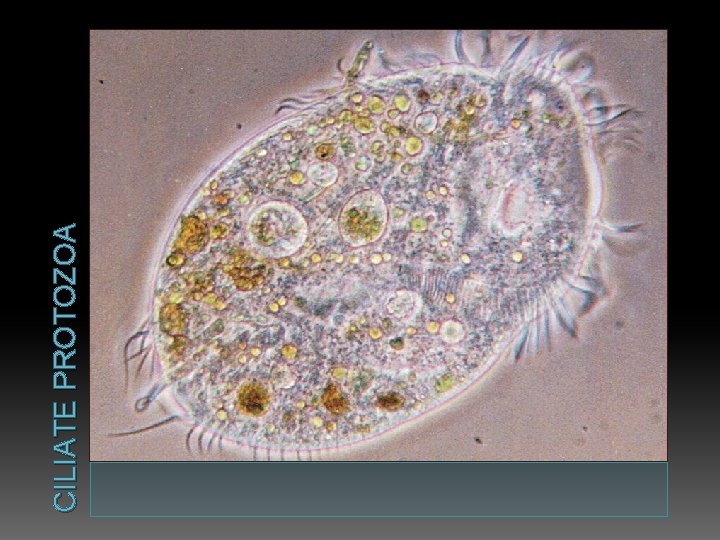 CILIATE PROTOZOA 