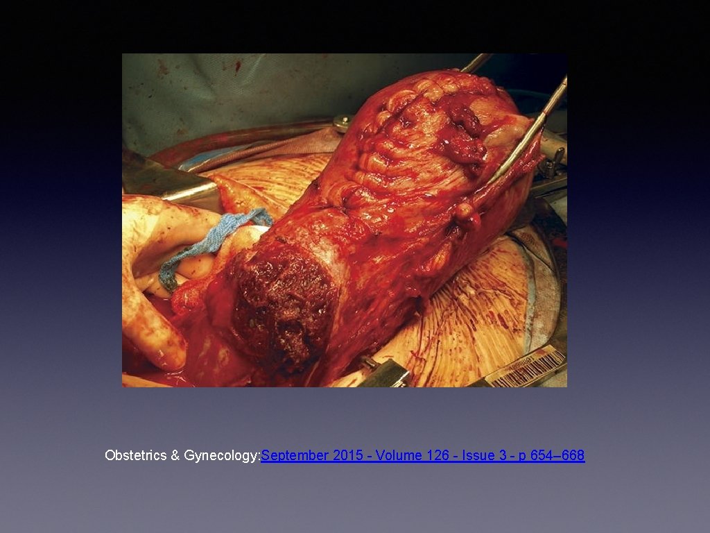 Obstetrics & Gynecology: September 2015 - Volume 126 - Issue 3 - p 654–