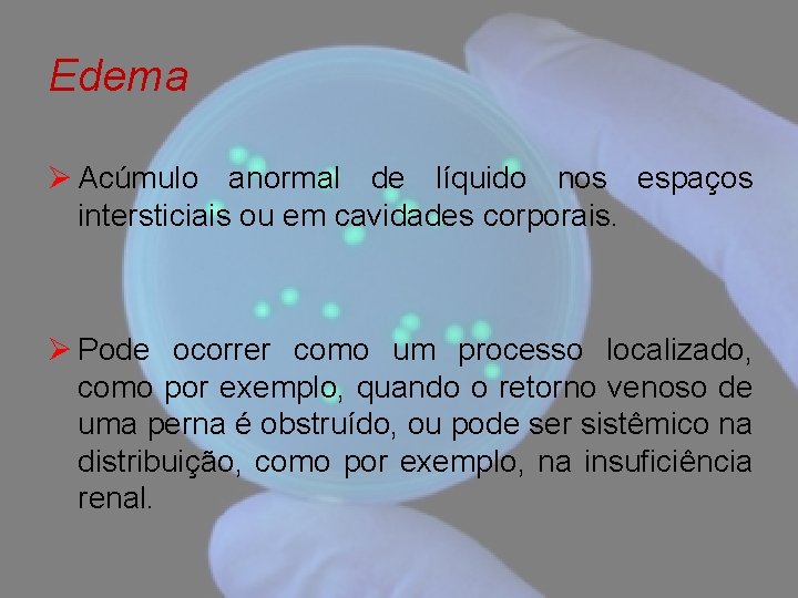 Edema Ø Acúmulo anormal de líquido nos espaços intersticiais ou em cavidades corporais. Ø