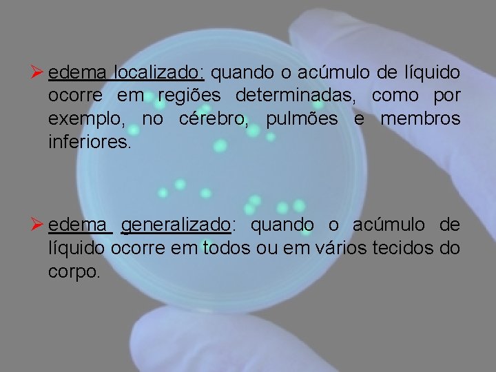 Ø edema localizado: quando o acúmulo de líquido ocorre em regiões determinadas, como por