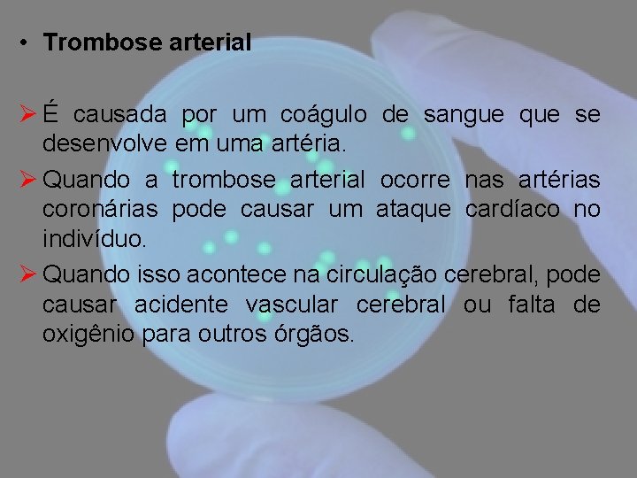  • Trombose arterial Ø É causada por um coágulo de sangue que se