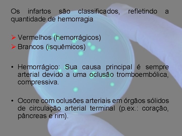 Os infartos são classificados, quantidade de hemorragia refletindo a Ø Vermelhos (hemorrágicos) Ø Brancos