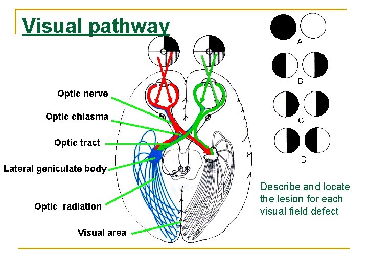 Visual pathway Optic nerve Optic chiasma Optic tract Lateral geniculate body Optic radiation Visual Visual pathway Optic nerve Optic chiasma Optic tract Lateral geniculate body Optic radiation Visual