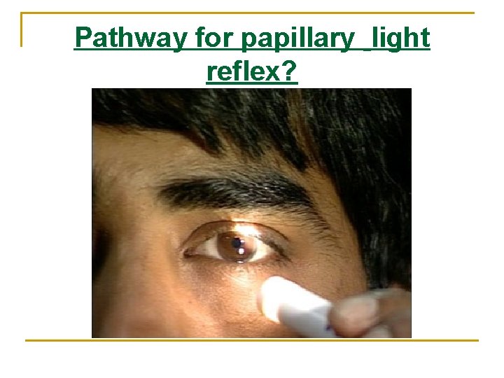 Pathway for papillary light reflex? Pathway for papillary light reflex?