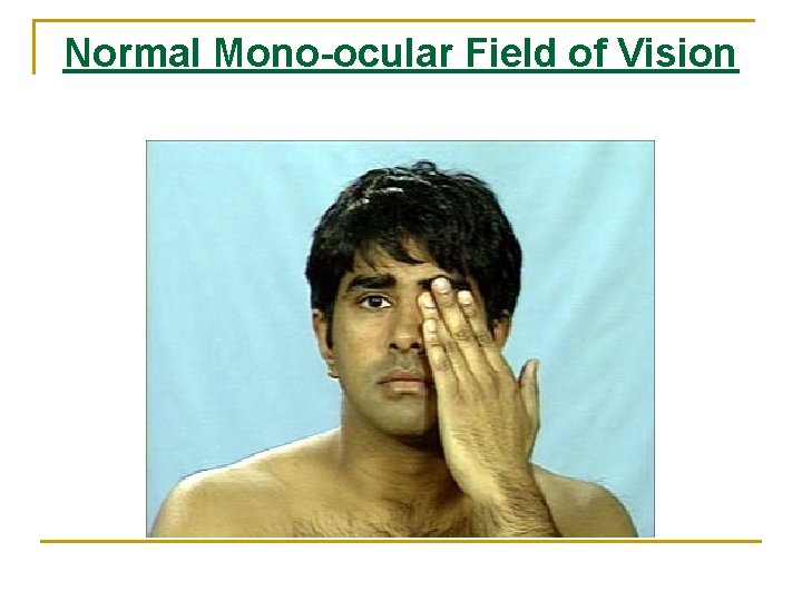 Normal Mono-ocular Field of Vision Normal Mono-ocular Field of Vision