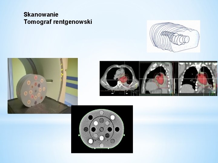 Skanowanie Tomograf rentgenowski 