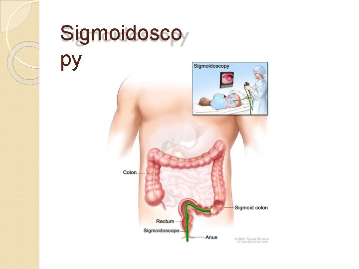 Sigmoidosco py 