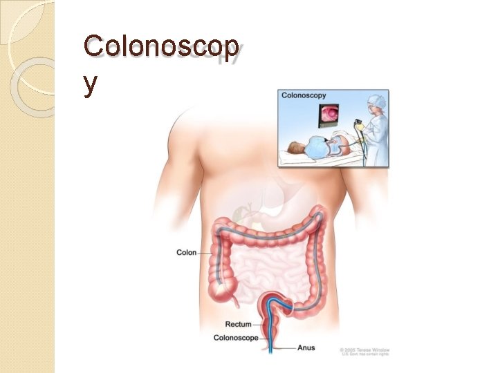 Colonoscop y 