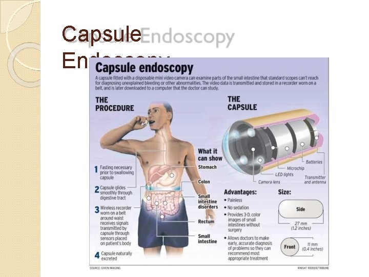 Capsule Endoscopy 