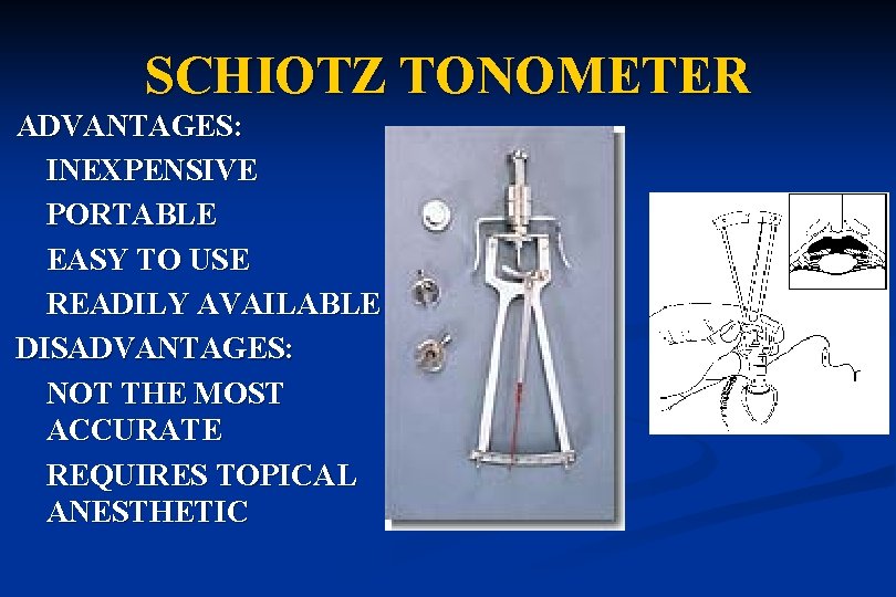 SCHIOTZ TONOMETER ADVANTAGES: INEXPENSIVE PORTABLE EASY TO USE READILY AVAILABLE DISADVANTAGES: NOT THE MOST