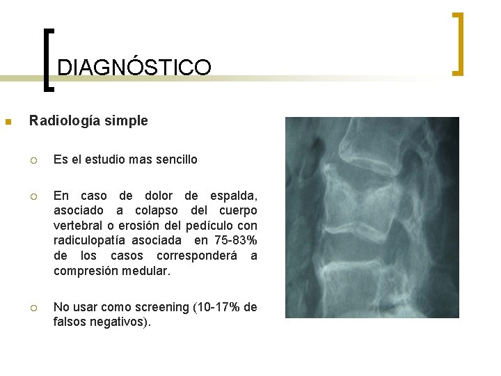 DIAGNÓSTICO n Radiología simple ¡ Es el estudio mas sencillo ¡ En caso de