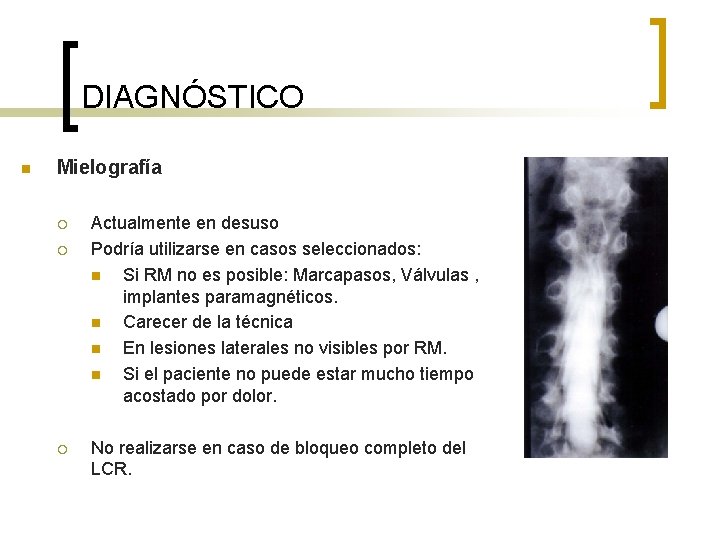 DIAGNÓSTICO n Mielografía ¡ ¡ ¡ Actualmente en desuso Podría utilizarse en casos seleccionados: