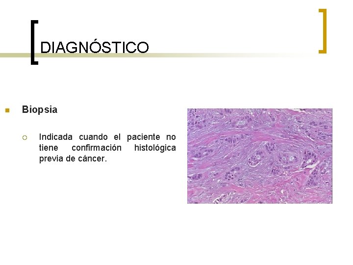 DIAGNÓSTICO n Biopsia ¡ Indicada cuando el paciente no tiene confirmación histológica previa de