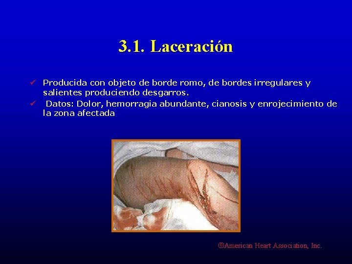 3. 1. Laceración ü Producida con objeto de borde romo, de bordes irregulares y