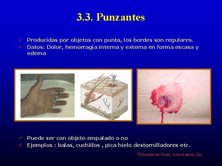 3. 3. Punzantes ü Producidas por objetos con punta, los bordes son regulares. ü