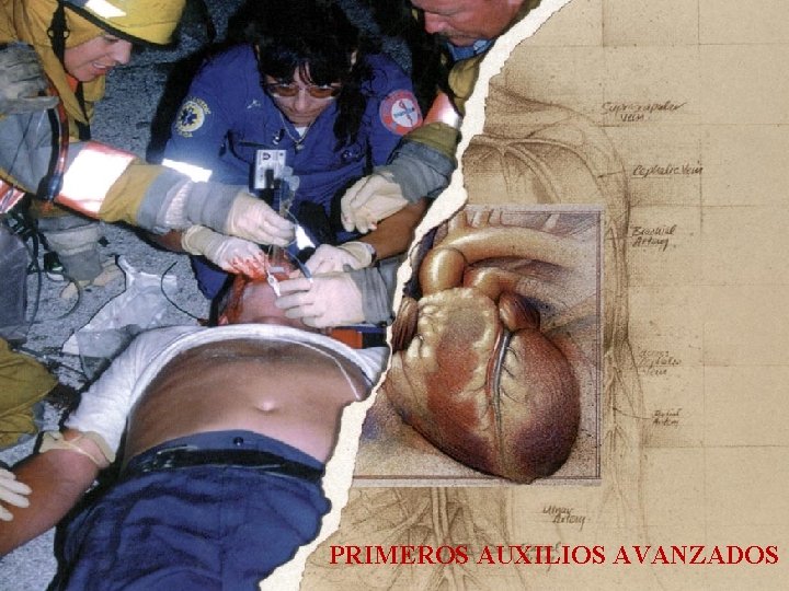 ©American Heart Association, Inc. PRIMEROS AUXILIOS AVANZADOS 