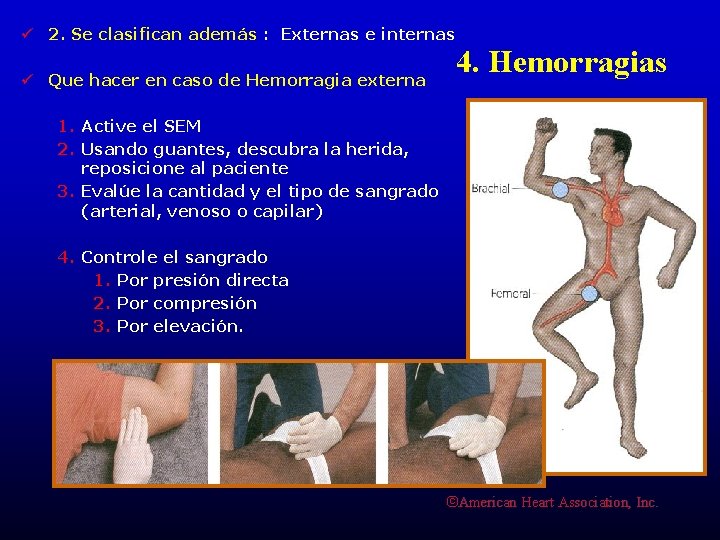ü 2. Se clasifican además : Externas e internas ü Que hacer en caso