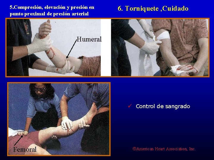 5. Compresión, elevación y presión en punto proximal de presión arterial 6. Torniquete ,