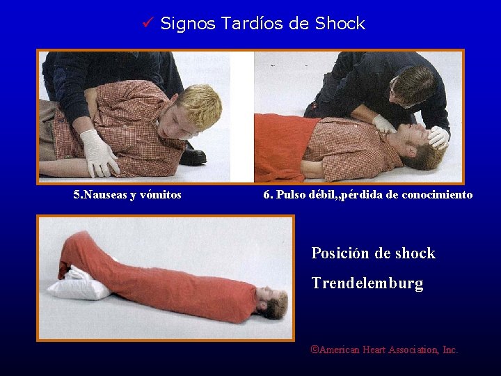 ü Signos Tardíos de Shock 5. Nauseas y vómitos 6. Pulso débil, , pérdida
