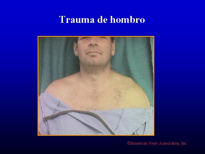 Trauma de hombro ©American Heart Association, Inc. 