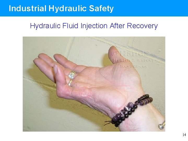 Industrial Hydraulic Safety Hydraulic Fluid Injection After Recovery 14 