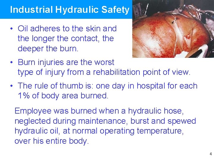 Industrial Hydraulic Safety • Oil adheres to the skin and the longer the contact,