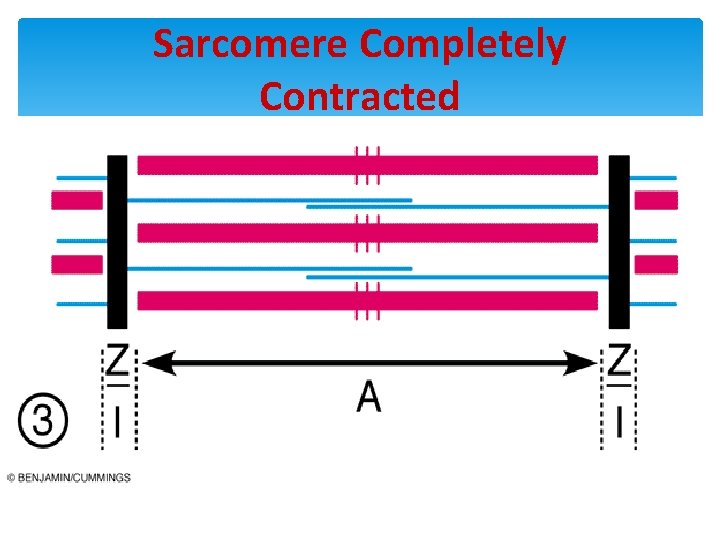 Sarcomere Completely Contracted 