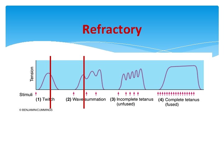 Refractory 